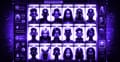Psychological Effects of Character.AI and Parasocial Obsession